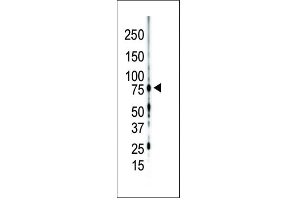 PKC gamma Antikörper  (C-Term)