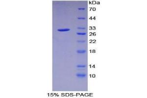SDS-PAGE analysis of Human PRKAg1 Protein. (PRKAG1 Protein)