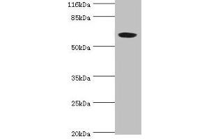 Western blot All lanes: SLC13A4 antibody at 2 μg/mL + 293T whole cell lysate Secondary Goat polyclonal to rabbit IgG at 1/10000 dilution Predicted band size: 69 kDa Observed band size: 69 kDa (SLC13A4 Antikörper  (AA 134-273))