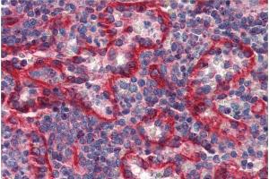 Immunohistochemistry staining of human spleen (paraffin sections) with anti-HLA-E (clone MEM-E/07). (HLA-E Antikörper)