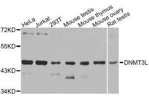 Western blot analysis of extracts of various cell lines, using DNMT3L antibody. (DNMT3L Antikörper  (AA 151-386))