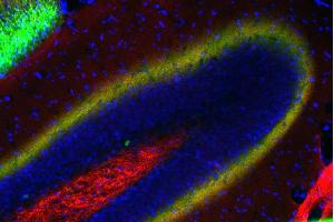 Immunostaining of a PFA fixed mouse hippocampus section with anti-Doc2a/b (dilution 1 : 200; red) and Oyster® 650 labeled anti-calretinin (cat. (Doc 2a/b (AA 1-403) Antikörper)