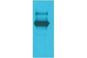 Western Blotting (WB) image for anti-LexA DNA Binding Region antibody (ABIN3179078) (LexA DNA Binding Region Antikörper)