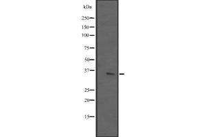Western blot analysis of ING2 expression in T47-D cell lysate,The lane on the left is treated with the antigen-specific peptide. (ING2 Antikörper  (C-Term))