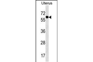 Western blot analysis in Uterus tissue lysates (35ug/lane). (Phosphoglucomutase 3 Antikörper  (AA 237-263))