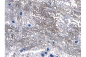 IHC-P analysis of Rat Spinal cord Tissue, with DAB staining. (RANKL Antikörper  (AA 106-240))