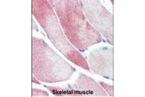Formalin-fixed and paraffin-embedded human Skeletal Muscle tissue reacted with JMJD3 Antibody (C-term) (ABIN387863 and ABIN2844040) , which was peroxidase-conjugated to the secondary antibody, followed by AEC staining.