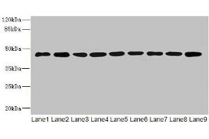 Western blot All lanes: SH3GLB2 antibody at 1 μg/mL Lane 1: Hela whole cell lysate Lane 2: Mouse gonadal tissue Lane 3: Mouse lung tissue Lane 4: U87 whole cell lysate Lane 5: THP-1 whole cell lysate Lane 6: A549 whole cell lysate Lane 7: MCF-7 whole cell lysate Lane 8: Mouse liver tissue Lane 9: A431 whole cell lysate Secondary Goat polyclonal to rabbit IgG at 1/10000 dilution Predicted band size: 44, 45 kDa Observed band size: 44 kDa (SH3GLB2 Antikörper  (AA 1-395))