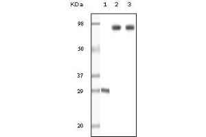 Western Blotting (WB) image for anti-zeta-Chain (TCR) Associated Protein Kinase 70kDa (ZAP70) (truncated) antibody (ABIN2464121) (ZAP70 Antikörper  (truncated))