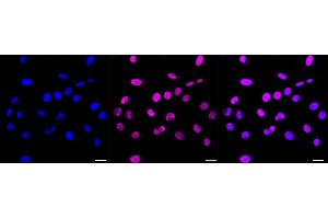 anti-Nucleoporin 50kDa (NUP50) antibody
