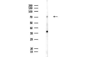anti-PR Domain Containing 8 (PRDM8) antibody