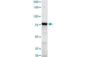 ADD3 polyclonal antibody (A01), Lot # CHI0060725QCS1.