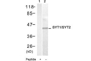 Image no. 1 for anti-Synaptotagmin I (SYT1) (Thr199), (Thr202) antibody (ABIN319342) (SYT1 Antikörper  (Thr199, Thr202))