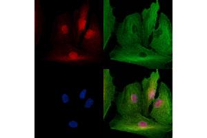 ABIN7094778 and ABIN7098829 staining  cells by IF/ICC. (SSRP1 Antikörper  (Internal Region))