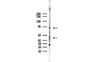 Western blot analysis of lysates from HepG2 cells(starvation,24h treatment), using NRG1 Antibody at 1/1000 dilution.