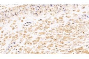 Immunohistochemistry (IHC) image for anti-Tenascin C (TNC) (AA 49-181) antibody (ABIN7426415)