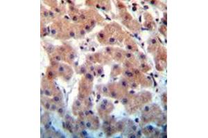 Immunohistochemistry analysis in formalin fixed and paraffin embedded human liver tissue reacted with INHBB Antibody (C-term) followed by peroxidase conjugation of the secondary antibody and DAB staining.