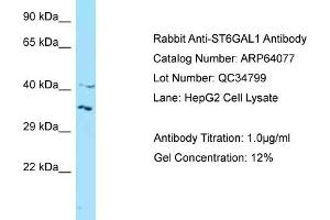 Western Blotting (WB) image for anti-ST6 beta-Galactosamide alpha-2,6-Sialyltranferase 1 (ST6GAL1) (N-Term) antibody (ABIN2789723) (ST6GAL1 Antikörper  (N-Term))
