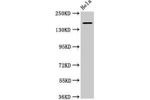 Western Blot Positive WB detected in: Hela whole cell lysate All lanes: ROBO1 antibody at 3.
