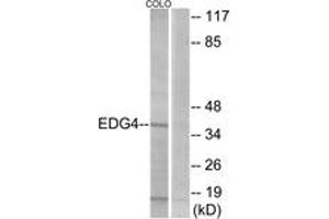 Western blot analysis of extracts from COLO205 cells, using EDG4 Antibody. (EDG4 Antikörper  (AA 290-339))