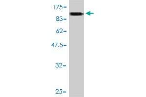 Western Blot detection against Immunogen (100. (SLC20A1 Antikörper  (AA 1-679))