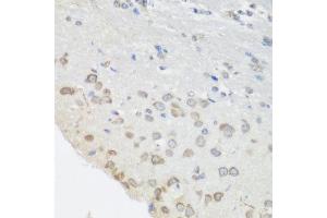 Immunohistochemistry of paraffin-embedded mouse brain using PUM1 antibody at dilution of 1:100 (40x lens). (PUM1 Antikörper)