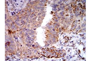 Immunohistochemistry (IHC) image for anti-Toll-Like Receptor 9 (TLR9) (AA 868-1016) antibody (ABIN5896728) (TLR9 Antikörper  (AA 868-1016))