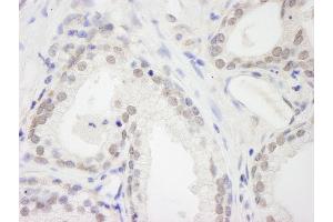 Immunohistochemistry (IHC) image for anti-RNA Binding Motif Protein 12 (RBM12) (AA 625-675) antibody (ABIN7448760) (RBM12 Antikörper  (AA 625-675))