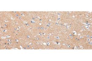 Immunohistochemistry of paraffin-embedded Human brain tissue using COLEC12 Polyclonal Antibody at dilution 1:40 (COLEC12 Antikörper)