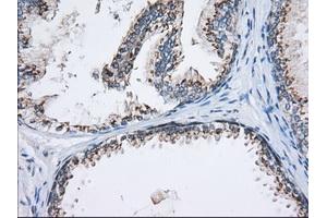 Immunohistochemical staining of paraffin-embedded Human Kidney tissue using anti-MOBKL1A mouse monoclonal antibody. (MOBKL1A Antikörper)