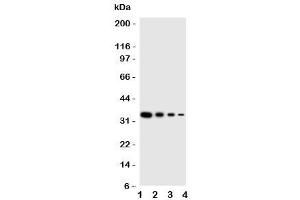 Western blot testing of PKR antbody (EIF2AK2 Antikörper  (N-Term))