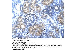 Human kidney (TRIM15 Antikörper  (N-Term))