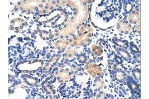 Image no. 1 for anti-EMG1 Nucleolar Protein Homolog (EMG1) (AA 51-100) antibody (ABIN6736233) (EMG1 Antikörper  (AA 51-100))