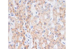 Immunohistochemistry of paraffin-embedded Human liver using AREG Polyclonal Antibody at dilution of 1:100 (40x lens). (Amphiregulin Antikörper)