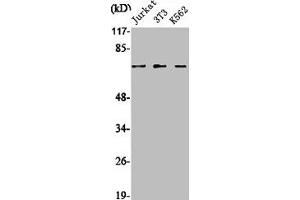 Western Blot analysis of Jurkat NIH-3T3 K562 cells using SENP1 Polyclonal Antibody (SENP1 Antikörper  (N-Term))