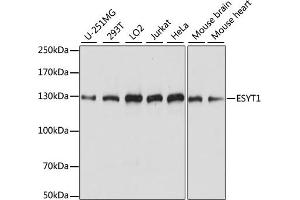 Western blot analysis of extracts of various cell lines, using ESYT1 antibody (ABIN7267069) at 1:1000 dilution. (ESYT1 Antikörper  (AA 90-220))