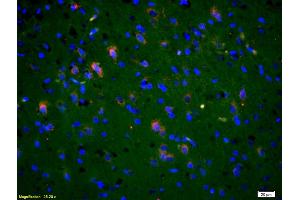 Formalin-fixed and paraffin-embedded rat brain labeled with Anti-Phospho-NMDAR2B (Tyr1336) Polyclonal Antibody, Unconjugated (ABIN801228) 1:200, overnight at 4°C, The secondary antibody was Goat Anti-Rabbit IgG, Cy3 conjugated used at 1:200 dilution for 40 minutes at 37°C. (GRIN2B Antikörper  (pTyr1336))