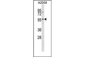 Western blot analysis of NACC2 / BTBD14A Antibody (C-term) in A2058 cell line lysates (35ug/lane).