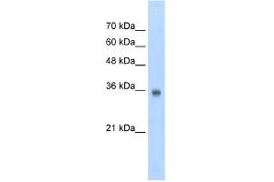 WB Suggested Anti-SOX2 Antibody Titration:  2. (SOX2 Antikörper  (N-Term))