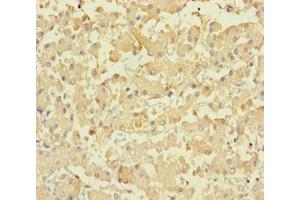 Immunohistochemistry of paraffin-embedded human liver tissue using ABIN7158418 at dilution of 1:100 (LPPR2 Antikörper  (AA 1-156))