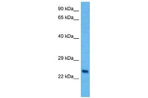 Host:  Mouse  Target Name:  PLP1  Sample Tissue:  Mouse Spleen  Antibody Dilution:  1ug/ml (PLP1 Antikörper  (N-Term))