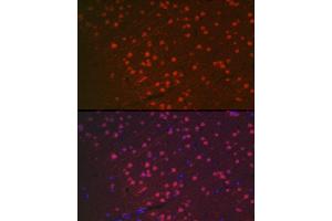 Immunofluorescence analysis of rat brain using [KO Validated] NeuN Rabbit pAb (ABIN3021158, ABIN3021159, ABIN1513254, ABIN1514400 and ABIN6214040) at dilution of 1:100 (40x lens).