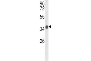 Western Blotting (WB) image for anti-Kruppel-Like Factor 6 (KLF6) antibody (ABIN3002701) (KLF6 Antikörper)