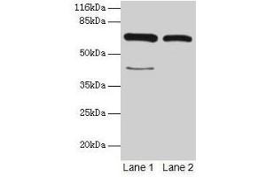 Western blot All lanes: CTPS1 antibody at 6 μg/mL Lane 1: Hela whole cell lysate Lane 2: 293T whole cell lysate Secondary Goat polyclonal to rabbit IgG at 1/10000 dilution Predicted band size: 67, 42 kDa Observed band size: 67 kDa (CTP Synthase Antikörper  (AA 300-554))