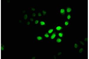 Immunofluorescence staining of Hela cells with ABIN7150950 at 1:100, counter-stained with DAPI. (CBX4 Antikörper  (AA 1-160))
