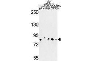 Western blot analysis of CHPF (arrow) in MDA-MB435, MCF-7, HepG2, A375 cell line and mouse testis tissue lysates (35ug/lane) using Chondroitin sulfate synthase 2 (CHPF Antikörper  (Middle Region))