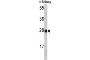 Western Blotting (WB) image for anti-Ethylmalonic Encephalopathy 1 (ETHE1) antibody (ABIN3002726) (ETHE1 Antikörper)