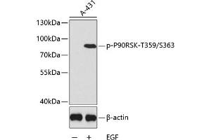 Western blot analysis of extracts of  cells, using Phospho-p90Rsk/RSK1/RPS6K-T359/S363 antibody (ABIN6135276, ABIN6136174, ABIN6136175 and ABIN6225566). (RPS6KA1 Antikörper  (pSer363, pThr359))