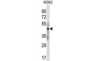 Western Blotting (WB) image for anti-Keratin 33B (KRT33B) antibody (ABIN3000386) (Keratin 33B Antikörper)
