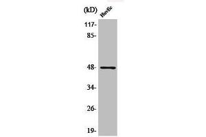 Western Blot analysis of HuvEc cells using Phospho-AP-1/Jun D (S73/100) Polyclonal Antibody (C-JUN Antikörper  (pSer73, pSer100))